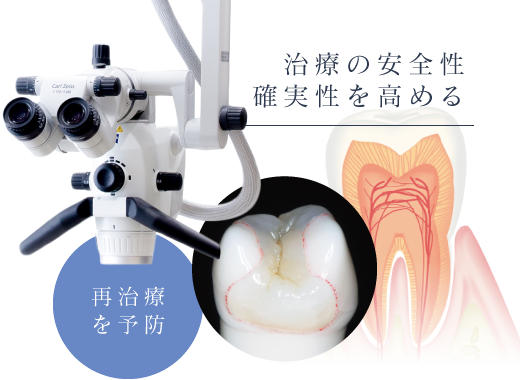 治療の安全性確実性を高める 再治療を予防