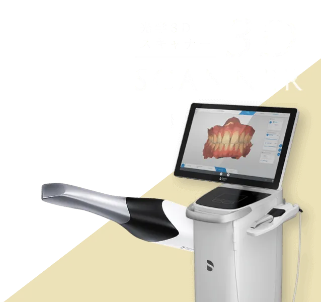 3Dスキャナー
